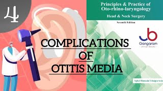 COMPLICATIONS OF OTITIS MEDIA PART4 ENT LECTURES [upl. by Mariejeanne]