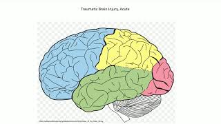 Acute Traumatic Brain Injury  Adventures in Neuropathology [upl. by Eentrok]