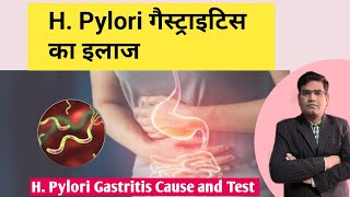 HPylori Gastritis Cause Symptoms and Treatment Explained in Hindi [upl. by Idner]