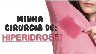 MINHA CIRURGIA DE HIPERIDROSE [upl. by Clarise943]