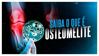 SAIBA O QUE É OSTEOMIELITE  Dr Américo Barbosa [upl. by Siberson]