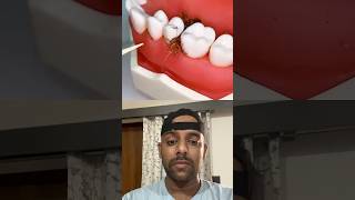 Teeth treatment shorts youtube facts reaction trendingshorts viralshorts [upl. by Priestley434]