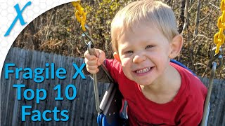 Fragile X Syndrome FXS 10 Things You Did Not Know [upl. by Pitt]