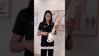 McKenzie Rear Lean For Back Pain Sciatica Relief backpainrelief sciaticapaintreatment sciatica [upl. by Rednaxela719]