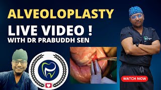 Dr Rudra Mohan  ALVEOLOPLASTY PROCEDURE LIVE  Preprosthetic Surgery  Smoothening Rough Jaw Bone [upl. by Aicilana]