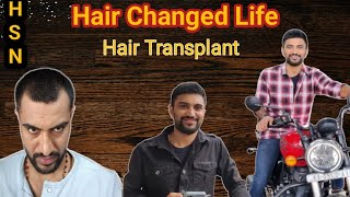 Hair Transplant result in Telugu HSN Hair transplant review  4 months completed [upl. by Marj]