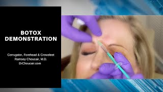 Botox® Demonstration Corrugators Forehead amp Crowsfeet  Ramsey Choucair MD  Ph 2143899797 [upl. by Anaehr]