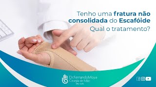 Tenho uma fratura não consolidada do Escafóide Qual o tratamento  Dr Fernando Moya CRM 112046 [upl. by Ylatfen323]