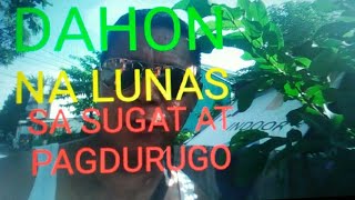 MABISANG GAMOT SA SUGAT AT PAGDURUGO ANG DAHON NG BAYABASJIMSNIL CHANNEL [upl. by Os126]