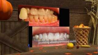 KoR Teeth Whitening System [upl. by Atalanta]