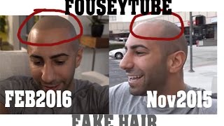 FouseyTUBE Fake Tattooed Hair  How He Got New Perfect Hairline [upl. by Jilly]