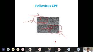 Lecture5 SBL704 Virology 15 01 2022 [upl. by Anahsit]