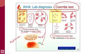 Hematology  2  U1L11  Coombs test [upl. by Ydieh]