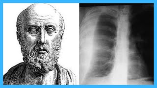 Top 12 Contributions of Hippocrates [upl. by Imled64]