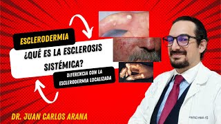 Esclerosis Sistémica y Esclerodermia localizada diferencias y características [upl. by Theodora]