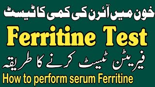 How to perform serum ferritine testفیریٹن ٹیسٹ کرنے کا طریقہ [upl. by Dranek]