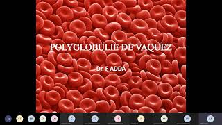 Polyglobulie de vaquez [upl. by Tiffanie]