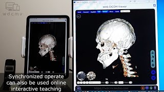 Start Medical Imagebased Teleconsultation using Web DICOM Viewer on iPad via Web Push Notification [upl. by Li]