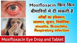 Moxifloxacin eye drops  moxifloxacin eye drops uses hindi  Best Eye drop  use side effects amp Dose [upl. by Kreitman]