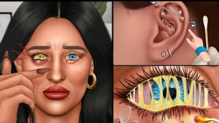 Satisfying eye stone removal animation Conjunctivitis Treatmentears cleaning [upl. by Marjy]