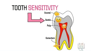 Theories of Dentin Sensitivity Hypersensitivity [upl. by Pike]