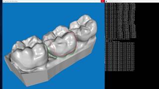 Offsetting a curve across a mesh surface  Polygonica Demo [upl. by Tillinger479]