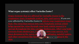 Understanding Varicella Zoster Virus Infection 🦠 [upl. by Cherice]