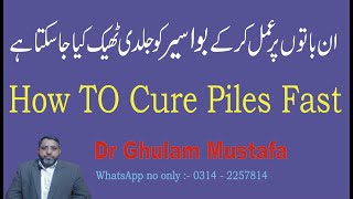 How To Cure Piles Fast [upl. by Olds]