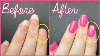 FIX A BROKEN NAIL FAST [upl. by Novled986]