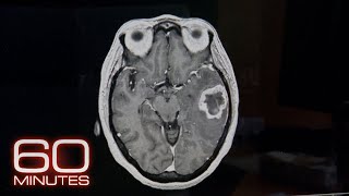 Frontotemporal Dementia  60 Minutes Archive [upl. by Boswall]