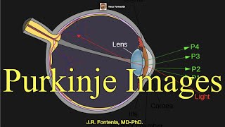 Purkinje Images PurkinjeSanson images [upl. by Nyltiak498]