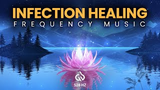 Infection Healing Frequency Music 528 Hz Solfeggio to Heal All Infections [upl. by Calondra]