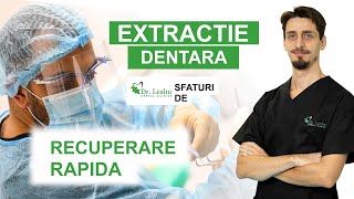 Cat timp dureaza vindecarea gingiei dupa extractia dentara  Clinicile Dentare Dr Leahu [upl. by Revkah]