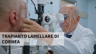 Il trapianto lamellare di cornea  Parliamo con il Prof Luigi Fontana [upl. by Eissoj]