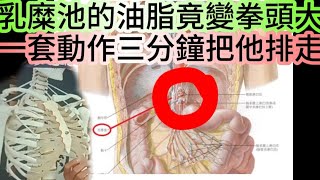 通淋巴要通總制：所有人油脂塞住的地方乳糜池：三動作把他打通淋巴上下全通：皮膚改善明顯：下腹下半身浮腫解消：世界級高人無私奉獻 [upl. by Merrel]