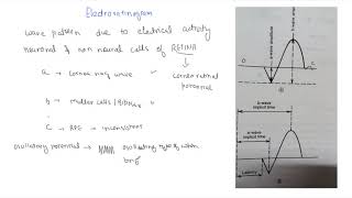 Electroretinogram [upl. by Yentroc]