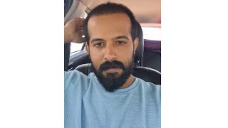 Going For Third Prp After Hairtransplantation LaDensitae Hair Transplantation Results🤍Subscribe Me [upl. by Marigolda]