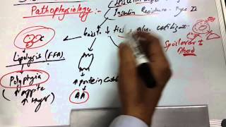 Diabetes Mellitus 3 of 6 Pathophysiology [upl. by Findley]