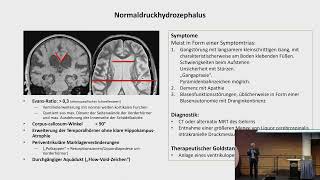 Vortrag „Differentialdiagnose idiopathischer Parkinson und atypisches ParkinsonSyndrom“ [upl. by Norina]