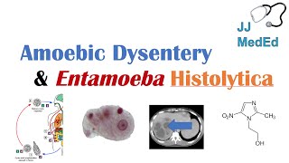 Amebiasis Amoebic Dysentery  Entamoeba histolytica Pathogenesis Signs amp Symptoms Treatment [upl. by Eugnimod]