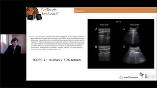 Webinar  Lung ultrasound Scoring procedures [upl. by Dietz]