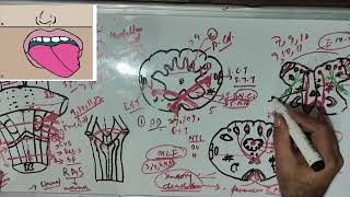 BRAIN STEM PART III CLINICAL FEATURES OF MEDULLA MEDIAL MEDULLARY SYNDROME [upl. by Conlee]