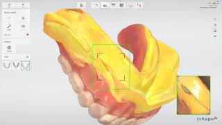 3Shape TRIOS Edentulous patient  Scannen bestaande prothese voor exacte kopie of afrdukprothese [upl. by Otnicaj]