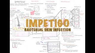 Impetigo Bacterial Skin Infection  Overview Clinical Presentation Pathophysiology Treatment [upl. by Blondy]