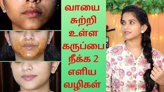 Day 6Skin Care  How To Remove Dark Black patches around Your Mouth amp Face Remedy for Pigmentation [upl. by Yanehs]