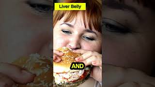 Belly Fat Bust Discover the 3 Types and Blast Them Away [upl. by Delinda74]