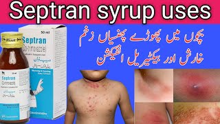 Septran syrup uses in Urduseptran syrupbacterial infection co trimoxazole [upl. by Morgun]