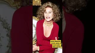 Jocelyn Wildenstein A Drastic Journey of Transformation  Before and Aftershorts [upl. by Barboza]