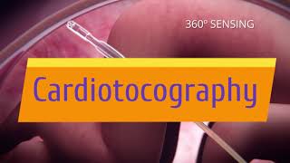 Cardiotocography Trailer [upl. by Aknahs]