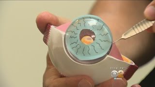 Implants Can Change Eye Color But Are They Worth The Risk [upl. by Gnel]